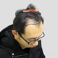發(fā)際線用戶圖片