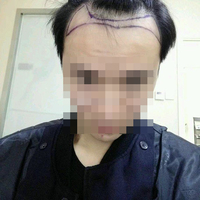 發(fā)際線用戶圖片