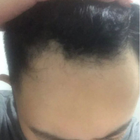 發(fā)際線用戶圖片