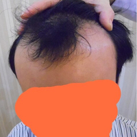 發(fā)際線用戶圖片