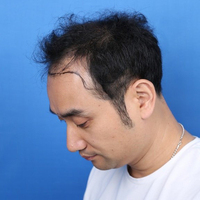發(fā)際線用戶圖片