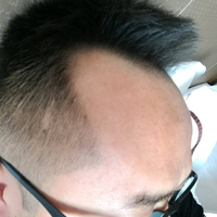 發(fā)際線用戶圖片