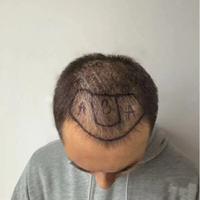 發(fā)際線用戶圖片