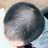 發(fā)際線用戶圖片