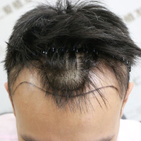 發(fā)際線用戶圖片