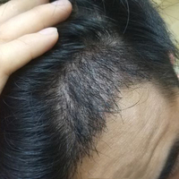 發(fā)際線用戶圖片