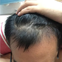 發(fā)際線用戶圖片