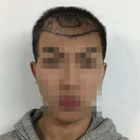 發(fā)際線用戶圖片