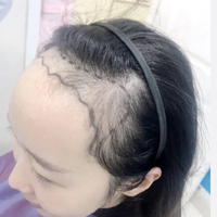 發(fā)際線用戶圖片