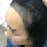發(fā)際線用戶圖片