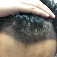 發(fā)際線(xiàn)用戶(hù)圖片