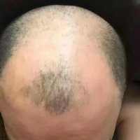 禿頂用戶(hù)圖片