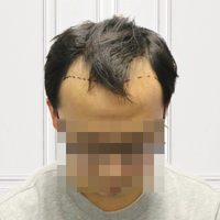 發(fā)際線用戶圖片