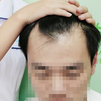 發(fā)際線用戶圖片