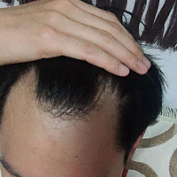 發(fā)際線用戶圖片