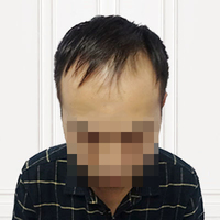 發(fā)際線用戶圖片