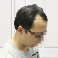 發(fā)際線用戶圖片