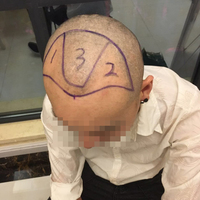 發(fā)際線用戶圖片