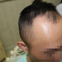 發(fā)際線用戶圖片