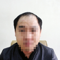 發(fā)際線用戶圖片