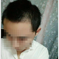 發(fā)際線用戶圖片