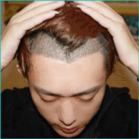 發(fā)際線用戶圖片