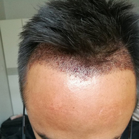 發(fā)際線用戶圖片