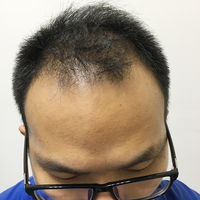 發(fā)際線用戶圖片