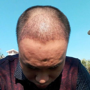发际线分享社区