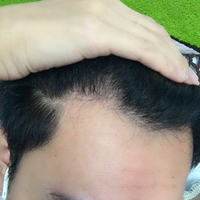 發(fā)際線用戶圖片