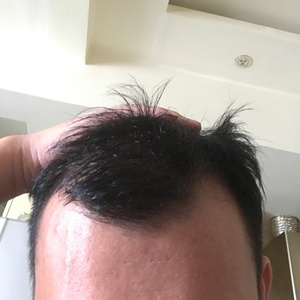 发际线分享社区