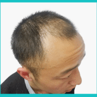 發(fā)際線用戶圖片