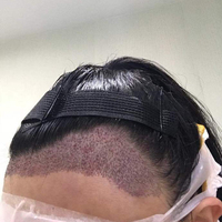 發(fā)際線用戶圖片