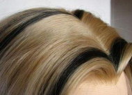美人尖和m型发际线区别 m型发际线容易秃顶吗
