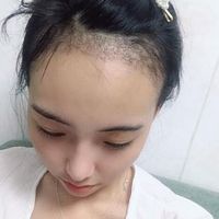 發(fā)際線用戶圖片
