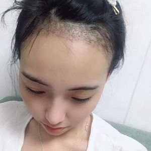 发际线分享社区