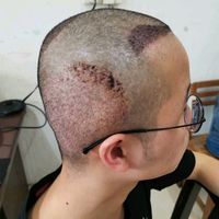 發(fā)際線用戶圖片