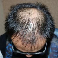 發(fā)際線用戶圖片