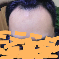 發(fā)際線用戶圖片