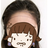 發(fā)際線用戶圖片