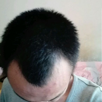 發(fā)際線用戶圖片