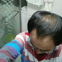 發(fā)際線用戶圖片