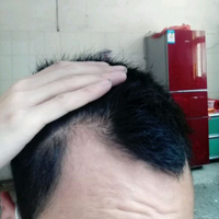 發(fā)際線用戶圖片