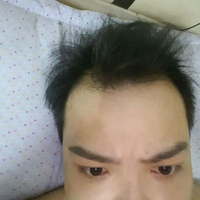 發(fā)際線用戶圖片