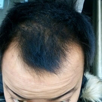 發(fā)際線用戶圖片