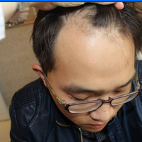發(fā)際線用戶圖片