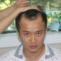 發(fā)際線用戶圖片