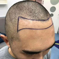 禿頂用戶圖片