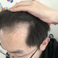 發(fā)際線用戶圖片