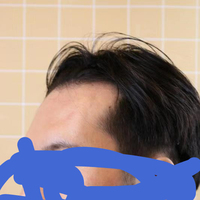 發(fā)際線用戶圖片